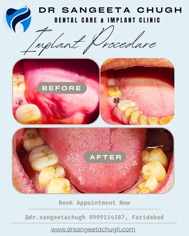 Photos of Dr. Sangeeta Chugh Dental Care & Implant Clinic....Best Dental Clinic /Best Dentist in Faridabad 2