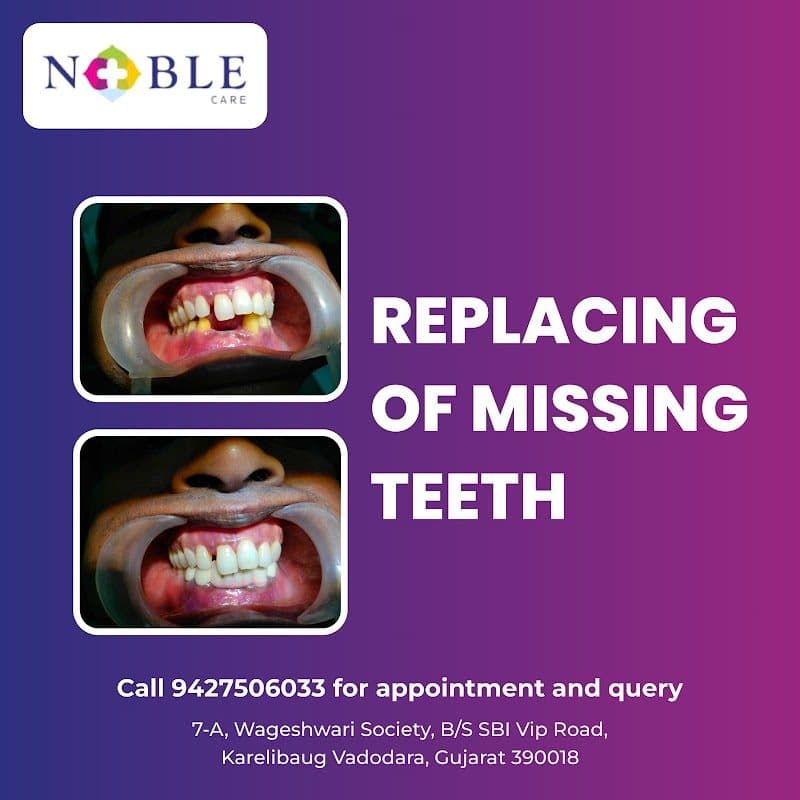 AD Dental Solutions - Dentist in Vadodara