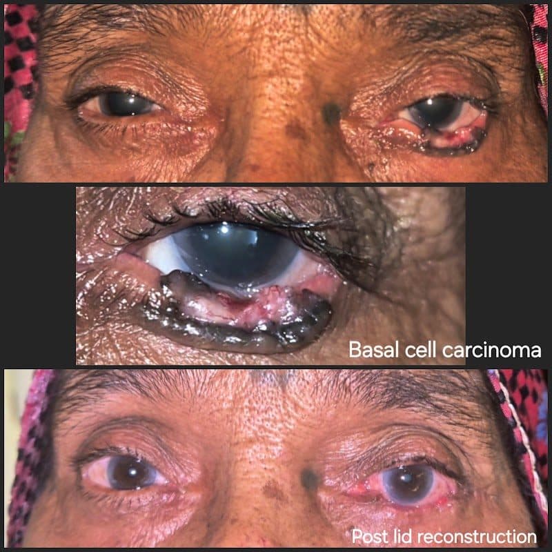 Dr Pooja Y Patel (Ptosis & Squint | Eyevista Eye Hospital )