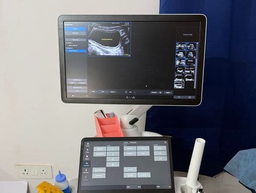 Ultrasound Machine Radiant Scan Center Ultrasound Machine Radiant Scan Center