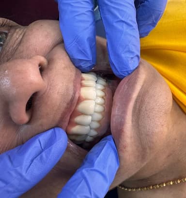 Devam Dental Care NEAR SHAHIBAUG Devam Dental Care NEAR SHAHIBAUG
