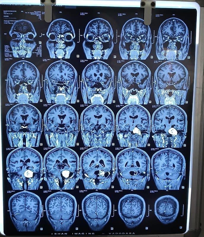 Headache Clinic By Dr (Prof) Sanjay Prakash Headache Clinic By Dr (Prof) Sanjay Prakash