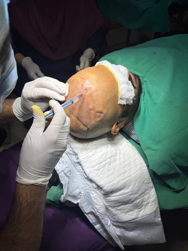 Dr. Uzair Khursheed - Dermatologist And Hair Transplant Surgeon Dr. Uzair Khursheed - Dermatologist And Hair Transplant Surgeon
