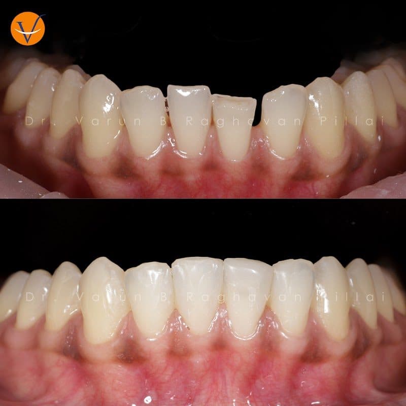 Radiance Dentistry Radiance Dentistry - Dentist in Thiruvananthapuram