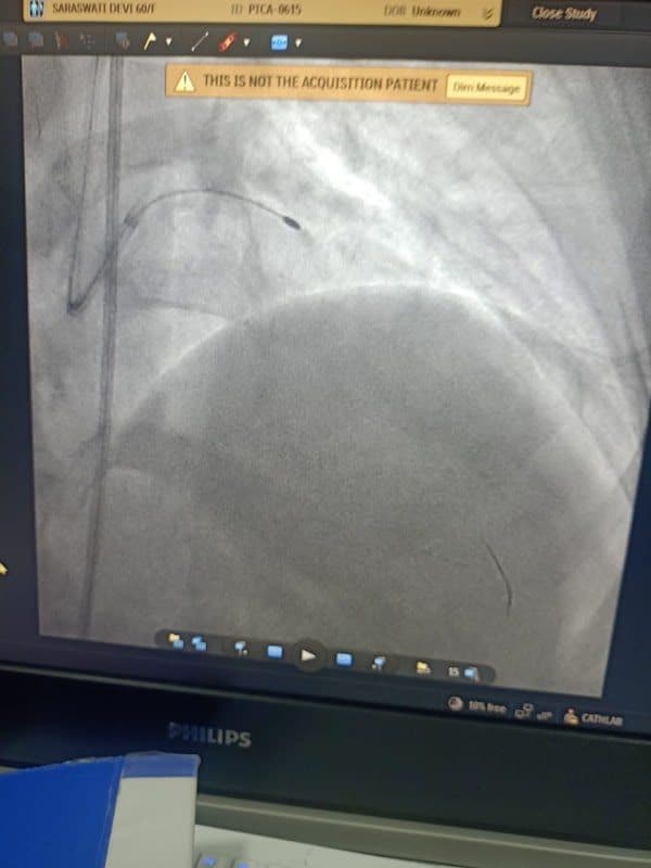 Dr Ankur Gautam, DM Cardiologist Dr Ankur Gautam, DM Cardiologist - Cardiologist in Greater Noida