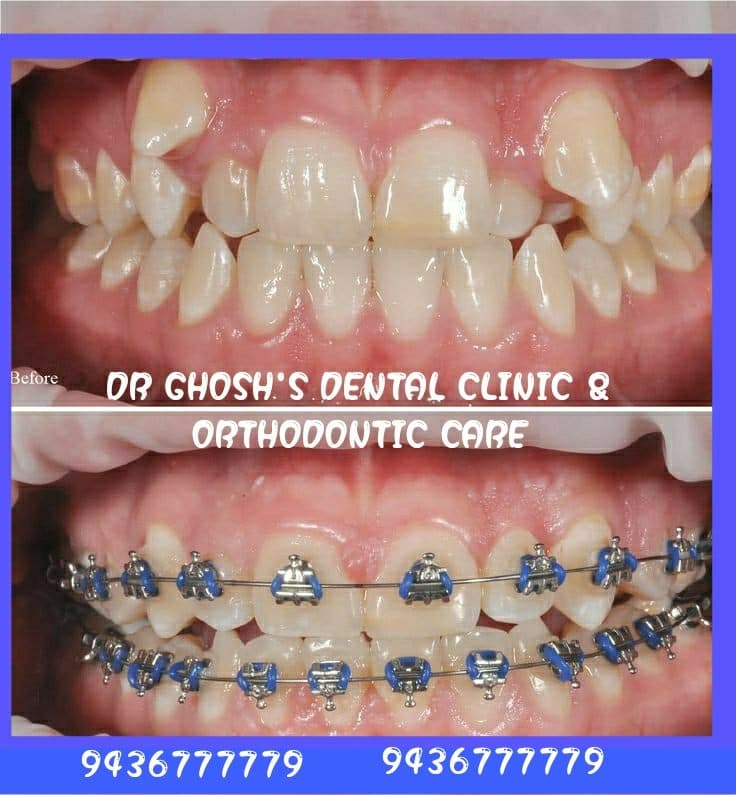 𝐃𝐫 𝐬𝐮𝐛𝐡𝐚𝐧𝐤𝐚𝐫 𝐩𝐚𝐮𝐥'𝐬 𝐃𝐞𝐧𝐭𝐚𝐥 𝐜𝐥𝐢𝐧𝐢𝐜 & 𝐢𝐦𝐩𝐥𝐚𝐧𝐭 𝐜𝐞𝐧𝐭𝐫𝐞 𝐃𝐫 𝐬𝐮𝐛𝐡𝐚𝐧𝐤𝐚𝐫 𝐩𝐚𝐮𝐥'𝐬 𝐃𝐞𝐧𝐭𝐚𝐥 𝐜𝐥𝐢𝐧𝐢𝐜 & 𝐢𝐦𝐩𝐥𝐚𝐧𝐭 𝐜𝐞𝐧𝐭𝐫𝐞 - Dentist in Agartala