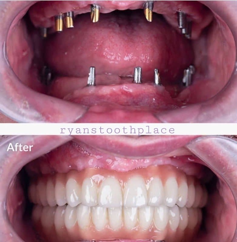 Vinola Dental Vinola Dental - Dentist in Salem