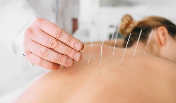Happy Needles Acupuncture Clinic Alappuzha Happy Needles Acupuncture Clinic Alappuzha
