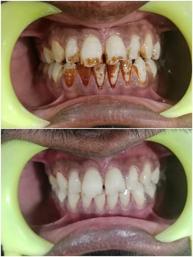 SHREE DENTAL CARE SHREE DENTAL CARE