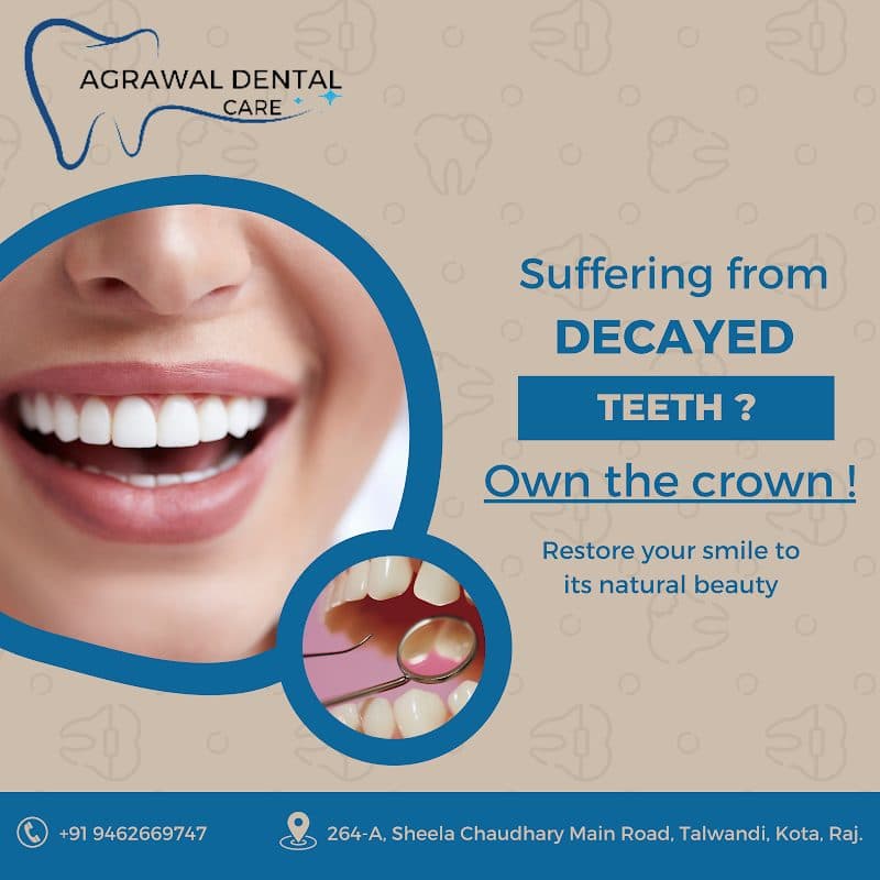 SmileBuds Dental Clinic || Best Dental Clinic in Kota || Best Dentist || SmileBuds Dental Clinic || Best Dental Clinic in Kota || Best Dentist ||