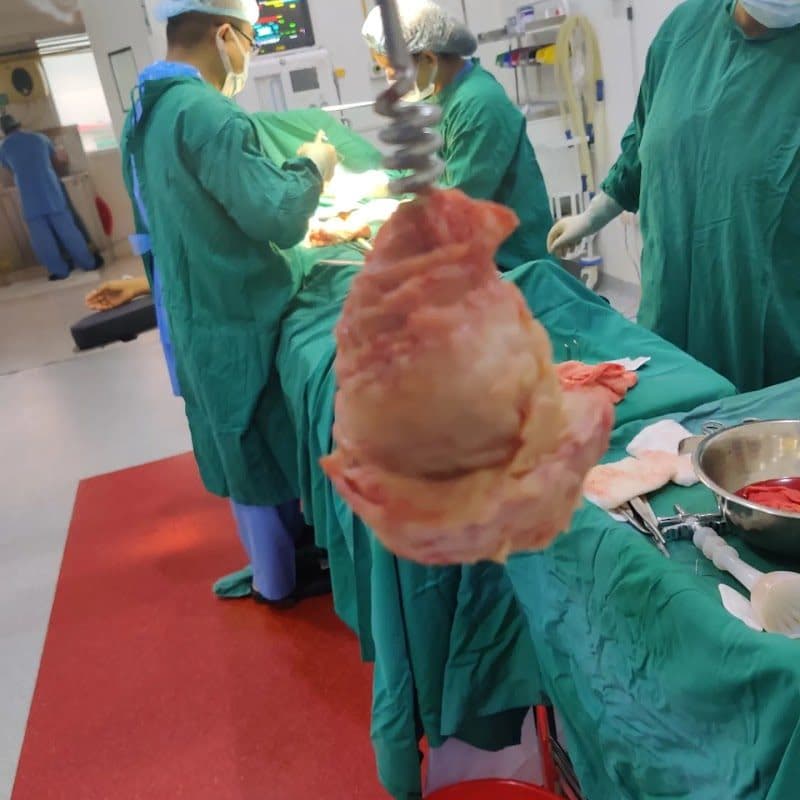 Dr Nabakanta Sharma Gynaecologist (M) Dr Nabakanta Sharma Gynaecologist (M) - Gynecologist in Imphal