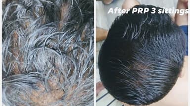 Dr Sumit Bhattacharjee -Skin Specialist and Cosmetologist Dr Sumit Bhattacharjee -Skin Specialist and Cosmetologist