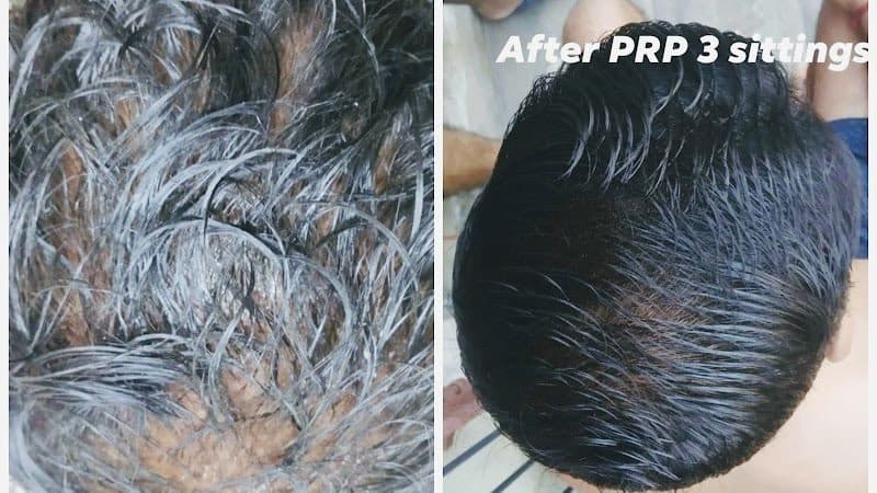 Dr Sumit Bhattacharjee -Skin Specialist and Cosmetologist Dr Sumit Bhattacharjee -Skin Specialist and Cosmetologist - Dermatologist in Agartala