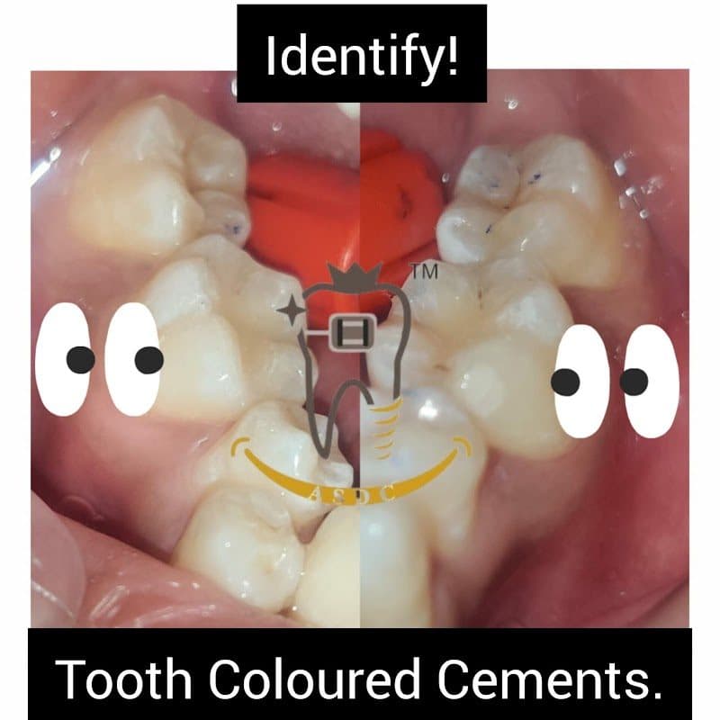 All Smiles Dental Club™ All Smiles Dental Club™ - Prosthodontist in Ahmedabad
