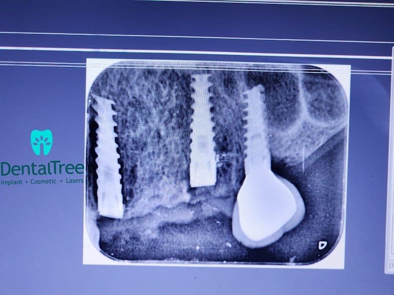 Dental Care Solutions | Best Dentist in Aundh, Pune Dental Care Solutions | Best Dentist in Aundh, Pune - Dentist in Pune
