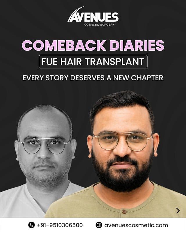 HAIR4LIFE` HAIR4LIFE` - Hair Transplant Surgeon in Ahmedabad