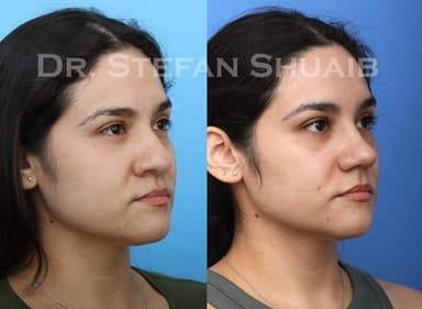 Dauwe Plastic Surgery Dauwe Plastic Surgery