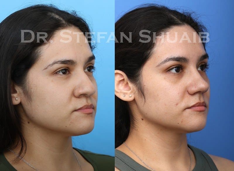 Vida Bela Plastic Surgery: Chelsea Snider MD Vida Bela Plastic Surgery: Chelsea Snider MD - Plastic Reconstruction Surgeon in Agartala