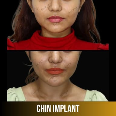 Dr Adarsh Tripathi Facial Plastic Surgeon in Delhi Dr Adarsh Tripathi Facial Plastic Surgeon in Delhi
