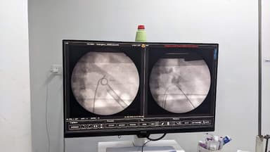 Dr Sandesh Surana- Best Urologist in Kothrud | kidney stone & prostate Cancer treatment in pune | stricture urethra treatment Dr Sandesh Surana- Best Urologist in Kothrud | kidney stone & prostate Cancer treatment in pune | stricture urethra treatment