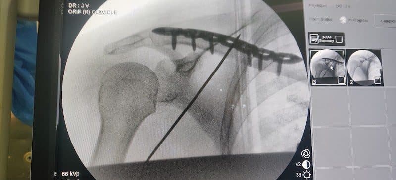 Dr Binoy P S Dr Binoy P S - Orthopedic Surgeon in Kochi