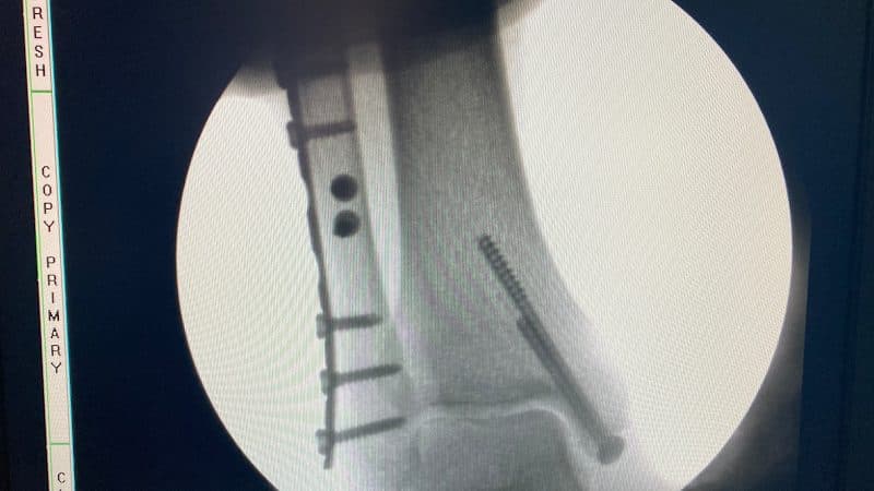 Dr Firoz Ahmed Dr Firoz Ahmed - Orthopedic Surgeon in Guwahati