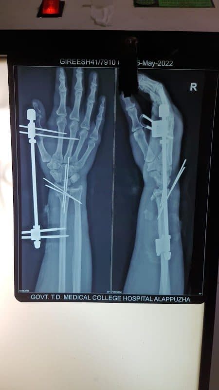 Dr. George M Srampickal Dr. George M Srampickal - Orthopedic Surgeon in Alappuzha