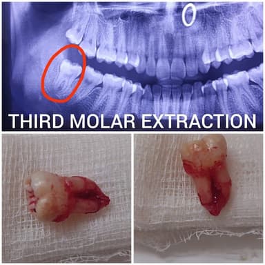 Dr.Moumita's(MDS),Om Sai Dental Care Dr.Moumita's(MDS),Om Sai Dental Care