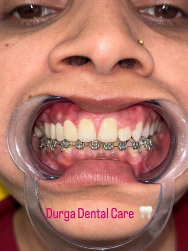 Dental Precision | Advanced Microscopic Dentistry Dental Precision | Advanced Microscopic Dentistry