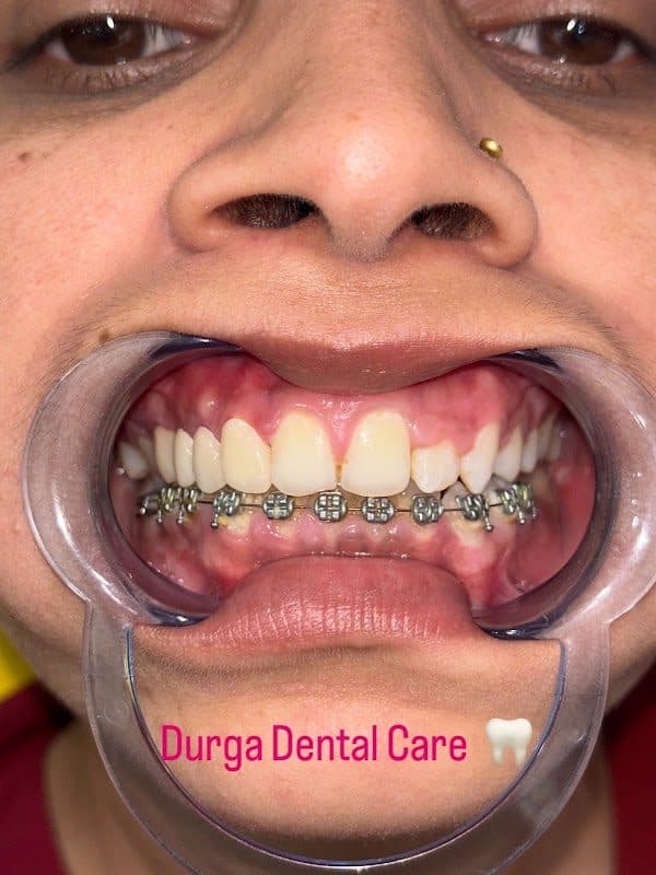 Dental Precision | Advanced Microscopic Dentistry Dental Precision | Advanced Microscopic Dentistry - Dentist in Bhopal