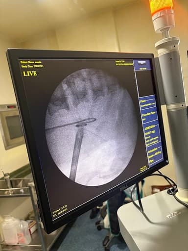Dr Saket Narnoli -Best Urologist Andrologist Uro-onco & Laproscopy Surgeon In Dhanbad Dr Saket Narnoli -Best Urologist Andrologist Uro-onco & Laproscopy Surgeon In Dhanbad