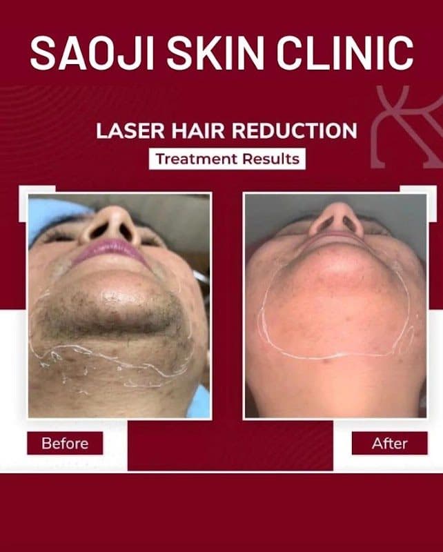 Dr Nitin Barde Dr Nitin Barde - Dermatologist in Nagpur