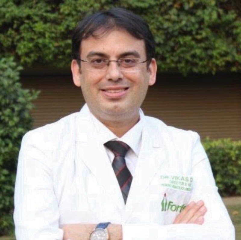 Dr Vikas Dua-Pediatric Hematologist in India, Pediatric Hemato Oncologist Delhi, BMT Specialist, Sickle Cell Anemia, Leukemia Dr Vikas Dua-Pediatric Hematologist in India, Pediatric Hemato Oncologist Delhi, BMT Specialist, Sickle Cell Anemia, Leukemia - Pediatric Hematologic-Oncologist in Agra