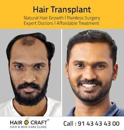 GATEWAY BEAUMONDE's Hair fixing GATEWAY BEAUMONDE's Hair fixing - Hair Transplant Surgeon in Alappuzha