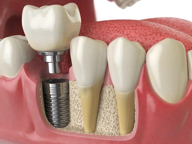 ToothPlaza Dental ToothPlaza Dental - Dentist in Greater Noida