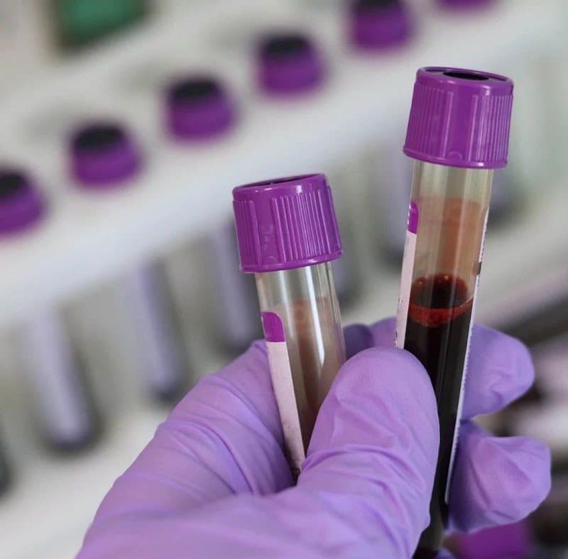 Unipath Specialty Laboratory - Gota - Ahmedabad Unipath Specialty Laboratory - Gota - Ahmedabad - Pathologist in Ahmedabad