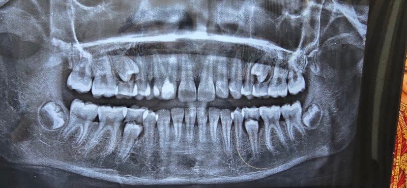 Dr Pooja Sharma - Dentist in Agra Dr Pooja Sharma - Dentist in Agra - Implantology in Agra