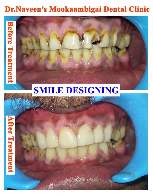 Smile Works Dental Zone Smile Works Dental Zone - Dentist in Tiruppur