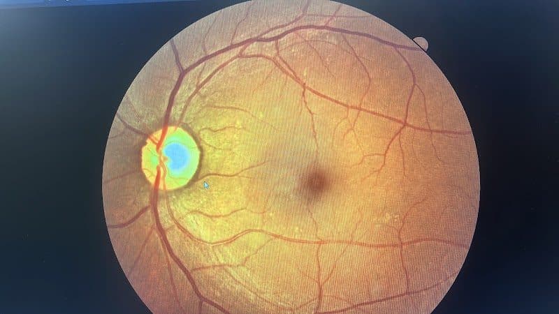 iRetina Advanced Eye Care iRetina Advanced Eye Care - ophthalmologist in Patna