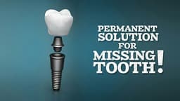 Shine Dental|Children & Adults Dental Hospital|Teeth Replacement & Implant Centre| Artificial Eyes Shine Dental|Children & Adults Dental Hospital|Teeth Replacement & Implant Centre| Artificial Eyes